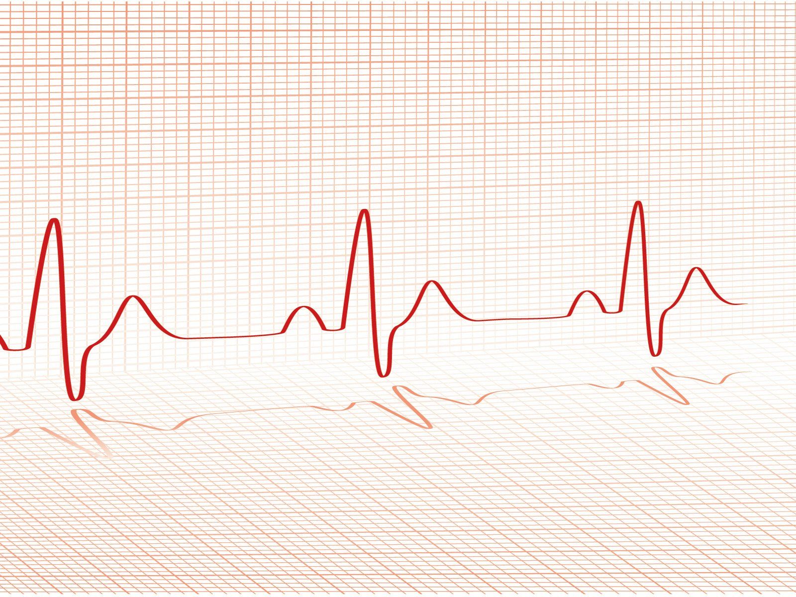 Kn95 Mask - An Overview Of This Popular Emergency Usage 1